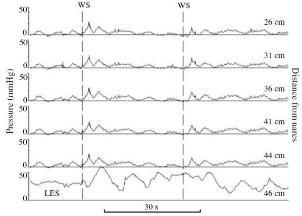 monometria-isof-1