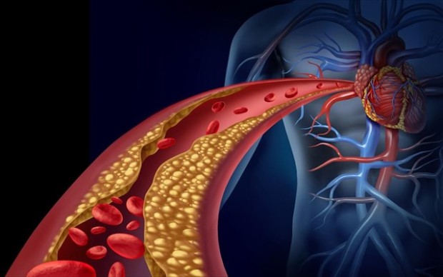 Οι μελέτες με υπολιπιδαιμικά φάρμακα απέδειξαν ότι η μείωση της χοληστερόλης ελαττώνει τα καρδιαγγειακά επεισόδια συμπεριλαμβανομένου και του καρδιακού θανάτου με συνοδό υποστροφή η/και σταθεροποίηση των αθηρωματικών βλαβών.