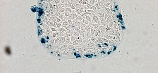 cancer-cells-864x400_c