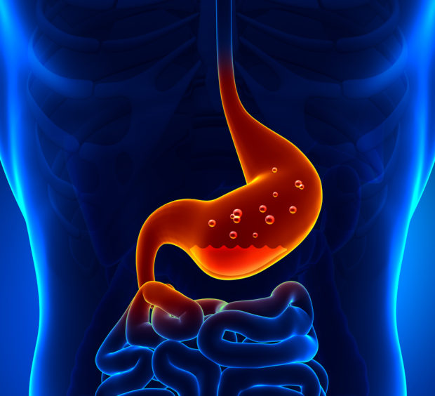 Gastric Acid - Human Anatomy - pain